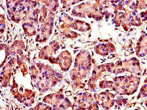 CSB-PA026119LA01HU
