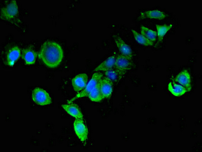 Immunofluorescent analysis of PC-3 cells using CSB-PA026138LA01HU at dilution of 1:100 and Alexa Fluor 488-congugated AffiniPure Goat Anti-Rabbit IgG(H+L)