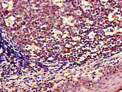 Immunohistochemistry of paraffin-embedded human tonsil tissue using CSB-PA026138LA01HU at dilution of 1:100