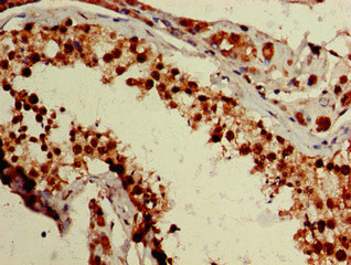 Immunohistochemistry of paraffin-embedded human testis tissue using CSB-PA026680LA01HU at dilution of 1:100 Immunohistochemistry of paraffin-embedded human testis tissue using CSB-PA026680LA01HU at dilution of 1:100