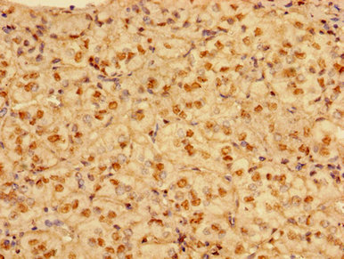 Immunohistochemistry of paraffin-embedded human adrenal gland tissue using CSB-PA03025A0Rb at dilution of 1:100