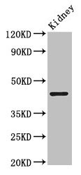 Western Blot Positive WB detected in: Mouse kidney tissue All lanes: PRMT1 antibody at 2.5microg/ml Secondary Goat polyclonal to rabbit IgG at 1/50000 dilution Predicted band size: 43, 40, 41, 33 kDa Observed band size: 43 kDa