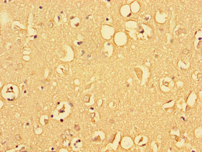 Immunohistochemistry of paraffin-embedded human brain tissue using CSB-PA05659A0Rb at dilution of 1:100