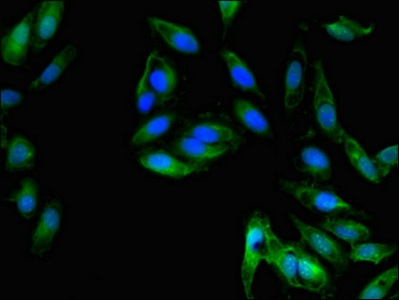 Immunofluorescence(IF) - CXCL8 Antibody
