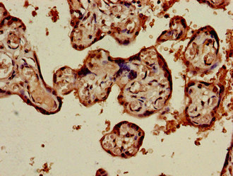 Immunohistochemistry of paraffin-embedded human placenta tissue using CSB-PA12309A0Rb at dilution of 1:100