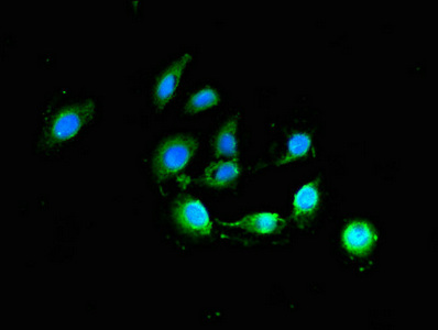 Immunofluorescence(IF) - BCL2 Antibody