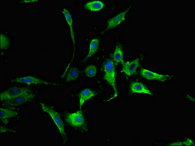 Immunofluorescence(IF) - MAPK8 Antibody
