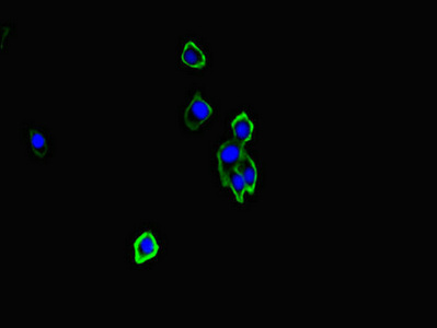 Immunofluorescent analysis of HepG2 cells using CSB-PA347832LA01HU at dilution of 1:100 and Alexa Fluor 488-congugated AffiniPure Goat Anti-Rabbit IgG(H+L) Immunofluorescent analysis of HepG2 cells using CSB-PA347832LA01HU at dilution of 1:100 and Alexa Fluor 488-congugated AffiniPure Goat Anti-Rabbit IgG(H+L)