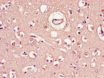 CSB-PA450719LA01HU