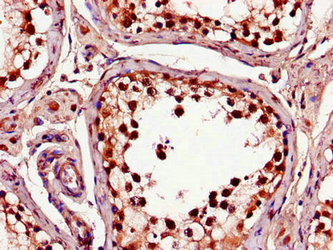 CSB-PA450719LA01HU