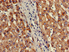 Immunohistochemistry of paraffin-embedded human liver tissue using CSB-PA613379LA01HU at dilution of 1:100 Immunohistochemistry of paraffin-embedded human liver tissue using CSB-PA613379LA01HU at dilution of 1:100
