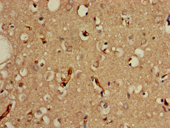 Immunohistochemistry of paraffin-embedded human brain tissue using CSB-PA613379LA01HU at dilution of 1:100