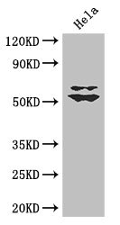 Western Blotting(WB) - KLF5 Antibody