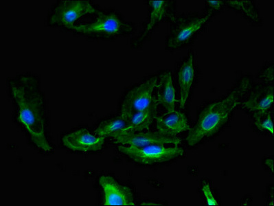 Immunofluorescent analysis of Hela cells using CSB-PA613684LA01HU at dilution of 1:100 and Alexa Fluor 488-congugated AffiniPure Goat Anti-Rabbit IgG(H+L)