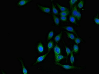 Immunofluorescent analysis of Hela cells using CSB-PA617909LA01HU at dilution of 1:100 and Alexa Fluor 488-congugated AffiniPure Goat Anti-Rabbit IgG(H+L)