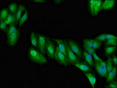 Immunofluorescent analysis of Hela cells using CSB-PA618981LA01HU at dilution of 1:100 and Alexa Fluor 488-congugated AffiniPure Goat Anti-Rabbit IgG(H+L)