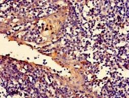 Immunohistochemistry of paraffin-embedded human tonsil tissue using CSB-PA618981LA01HU at dilution of 1:100