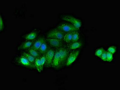 Immunofluorescence(IF) - MYLK Antibody