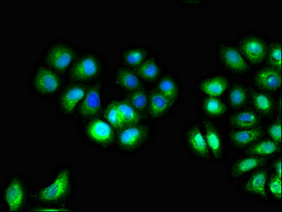 Immunofluorescence(IF) - IL10RA Antibody