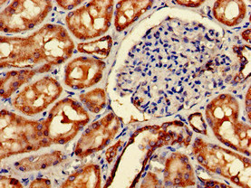 Immunohistochemistry of paraffin-embedded human kidney tissue using CSB-PA623101LA01HU at dilution of 1:100