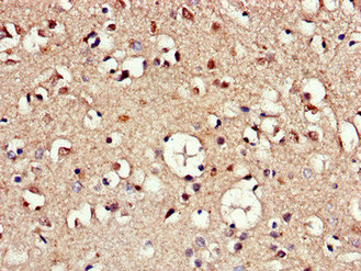 Immunohistochemistry of paraffin-embedded human brain tissue using CSB-PA643571LA01HU at dilution of 1:100
