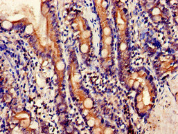 Immunohistochemistry of paraffin-embedded human small intestine tissue using CSB-PA754239LA01HU at dilution of 1:100