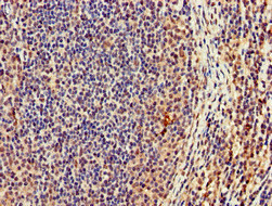 Immunohistochemistry of paraffin-embedded human lymph node tissue using CSB-PA754371LA01HU at dilution of 1:100