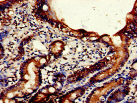 Immunohistochemistry of paraffin-embedded human small intestine tissue using CSB-PA757818LA01HU at dilution of 1:100