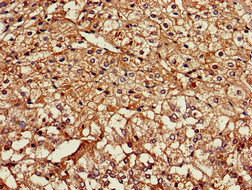 Immunohistochemistry of paraffin-embedded human adrenal gland tissue using CSB-PA757818LA01HU at dilution of 1:100
