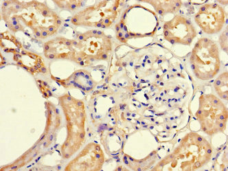 Immunohistochemistry of paraffin-embedded human kidney tissue using CSB-PA773602LA01HU at dilution of 1:100