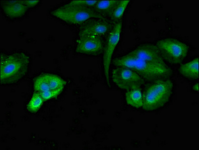 Immunofluorescent analysis of Hela cells using CSB-PA801231LA01HU at dilution of 1:100 and Alexa Fluor 488-congugated AffiniPure Goat Anti-Rabbit IgG(H+L)