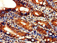 Immunohistochemistry of paraffin-embedded human small intestine tissue using CSB-PA801231LA01HU at dilution of 1:100 Immunohistochemistry of paraffin-embedded human small intestine tissue using CSB-PA801231LA01HU at dilution of 1:100