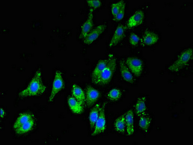 Immunofluorescent analysis of HepG2 cells using CSB-PA819476LA01HU at dilution of 1:100 and Alexa Fluor 488-congugated AffiniPure Goat Anti-Rabbit IgG(H+L) Immunofluorescent analysis of HepG2 cells using CSB-PA819476LA01HU at dilution of 1:100 and Alexa Fluor 488-congugated AffiniPure Goat Anti-Rabbit IgG(H+L)