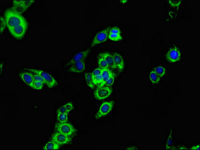 Immunofluorescence(IF) - CPT1B Antibody