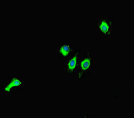 Immunofluorescent analysis of Hela cells using CSB-PA822202HA01HU at dilution of 1:100 and Alexa Fluor 488-congugated AffiniPure Goat Anti-Rabbit IgG(H+L)