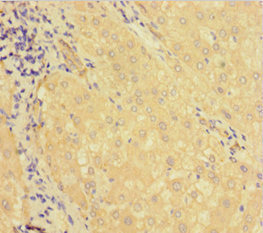 CSB-PA822748LA01HU