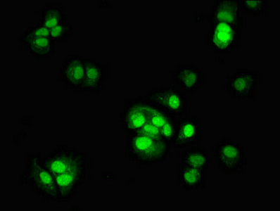 Immunofluorescent analysis of MCF-7 cells using CSB-PA836166HA01HU at dilution of 1:100 and Alexa Fluor 488-congugated AffiniPure Goat Anti-Rabbit IgG(H+L) Immunofluorescent analysis of MCF-7 cells using CSB-PA836166HA01HU at dilution of 1:100 and Alexa Fluor 488-congugated AffiniPure Goat Anti-Rabbit IgG(H+L)