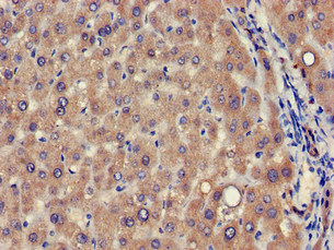 Immunohistochemistry of paraffin-embedded human liver tissue using CSB-PA836235LA01HU at dilution of 1:100