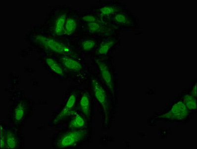 Immunofluorescent analysis of Hela cells using CSB-PA839279LA01HU at dilution of 1:100 and Alexa Fluor 488-congugated AffiniPure Goat Anti-Rabbit IgG(H+L)