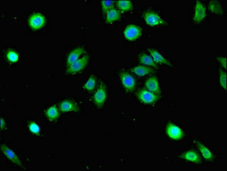 Immunofluorescent analysis of PC-3 cells using CSB-PA844730LA01HU at dilution of 1:100 and Alexa Fluor 488-congugated AffiniPure Goat Anti-Rabbit IgG(H+L)