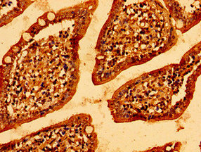 Immunohistochemistry of paraffin-embedded human small intestine tissue using CSB-PA847694LA01HU at dilution of 1:100