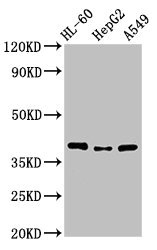 Western Blot Positive WB detected in: HL60 whole cell lysate, HepG2 whole cell lysate, A549 whole cell lysate All lanes: MCU antibody at 3.4microg/ml Secondary Goat polyclonal to rabbit IgG at 1/50000 dilution Predicted band size: 40, 37, 36 kDa Observed band size: 40 kDa