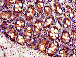 Immunohistochemistry of paraffin-embedded human small intestine tissue using CSB-PA849761LA01HU at dilution of 1:100