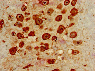 Immunohistochemistry of paraffin-embedded human placenta tissue using CSB-PA850247LA01HU at dilution of 1:100