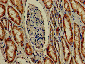Immunohistochemistry of paraffin-embedded human kidney tissue using CSB-PA850263LA01HU at dilution of 1:100 Immunohistochemistry of paraffin-embedded human kidney tissue using CSB-PA850263LA01HU at dilution of 1:100