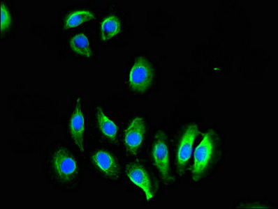 Immunofluorescent analysis of A549 cells using CSB-PA856900LA01HU at dilution of 1:100 and Alexa Fluor 488-congugated AffiniPure Goat Anti-Rabbit IgG(H+L) Immunofluorescent analysis of A549 cells using CSB-PA856900LA01HU at dilution of 1:100 and Alexa Fluor 488-congugated AffiniPure Goat Anti-Rabbit IgG(H+L)