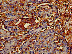 Immunohistochemistry of paraffin-embedded human pancreatic tissue using CSB-PA856900LA01HU at dilution of 1:100 Immunohistochemistry of paraffin-embedded human pancreatic tissue using CSB-PA856900LA01HU at dilution of 1:100