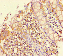 Immunohistochemistry of paraffin-embedded human colon tissue using CSB-PA857025LA01HU at dilution of 1:100 Immunohistochemistry of paraffin-embedded human colon tissue using CSB-PA857025LA01HU at dilution of 1:100