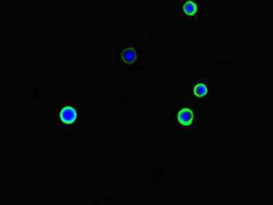 Immunofluorescence(IF) - ARHGDIG Antibody