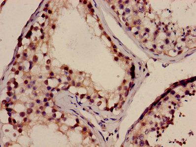 CSB-PA859098LA01HU